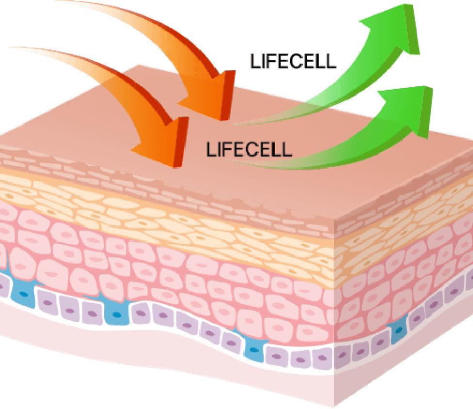 After LifeCell